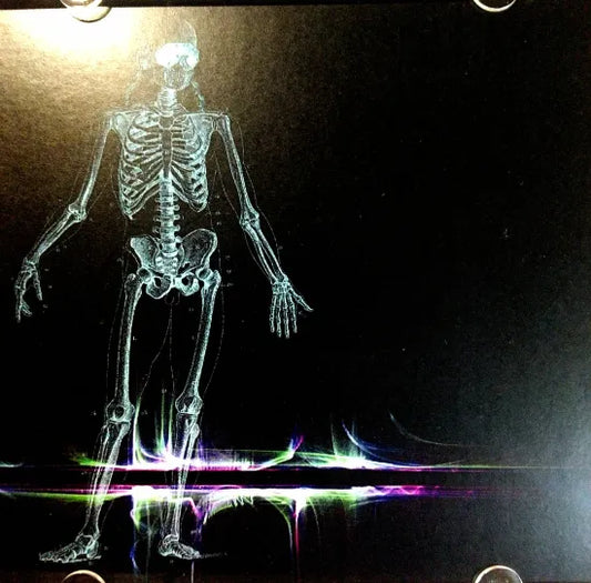 MEGADETH / Listen To This, Vic! STEREO SOUNDBOARD (1CDR)